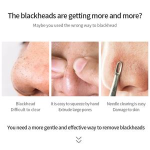 Más Vendido: Mascarilla Facial Original Exfoliante, Limpieza Profunda, Eliminación de Puntos Negros y Suciedad, Tiras para Poros de la Nariz - Product Image 2