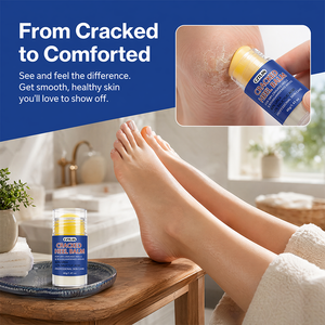 Crème pour les pieds à l'urée et à l'acide salicylique, marque privée, hydratante, exfoliante, réparatrice des peaux mortes, pour talons fendillés - Product Image 6