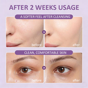 Nettoyant visage hydratant doux, extrait de racine d'Iris Florentina, hypoallergénique pour peaux sensibles, vente en gros - Product Image 3