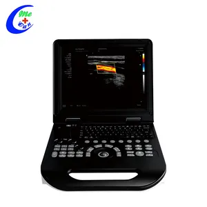 One-Stop Supplier Ultrasonic System Color Doppler Ultrasound Machine Ultrasound Scanning Machine For Animal Human Hospital