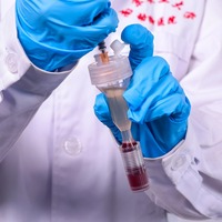 Centrífuga de Sangre para PRP Animal, 8 Tubos, Capacidad de 15 ml