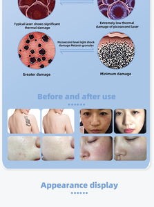 Nouvelle <span class=keywords><strong>machine</strong></span> de nettoyage des sourcils <span class=keywords><strong>pas</strong></span> chère 2026, nettoyage en profondeur, élimination des tatouages, des grains de beauté, <span class=keywords><strong>machine</strong></span> de beauté pour salon de spa - Product Image 6