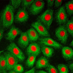 <span class=keywords><strong>Microscope</strong></span> biologique fluorescent trinoculaire à condensateur Abbe NA1.25 LED BS-2030FT BestScoep - Product Image 2