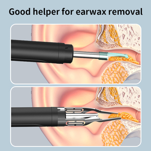 Limpiador Visual de Cera <span class=keywords><strong>para</strong></span> Oídos con Cámara HD, Recargable por Tipo-C, Diseño Inteligente Inalámbrico - Product Image 2