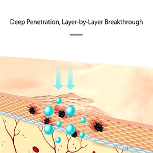 Crème <span class=keywords><strong>anti</strong></span>-acné à base de plantes du Yunnan, douce, non irritante, <span class=keywords><strong>anti</strong></span>-rougeurs, réparation des boutons, adaptée aux conditions humides, 20g - Product Image 4