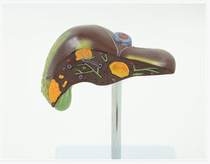 PVC病的肝臓モデルが一般的な肝および胆嚢障害を視覚化 - Product Image 4
