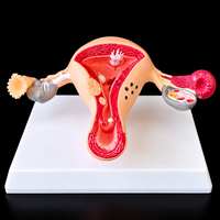 Modèle d'ovaire, modèle anatomique de l'organes reproducteurs féminins, outil éducatif médical