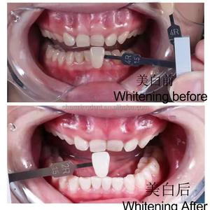 <span class=keywords><strong>Dr</strong></span>. Bleken Professionele Tandtanden Bleken Kit / Whitening Versneller Voor Persoonlijke Tanden Bleken Tandartsen Materiaal - Product Image 4