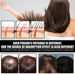 Nouveauté : Huile Essentielle Bio au Collagène et Vitamine B7 pour la Croissance, le Renforcement et la Prévention de la Casse des Cheveux, Adaptée à Tous Types de Cheveux - Product Image 3