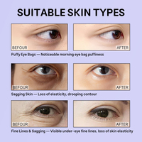 Patchs Hydrogel OEM Personnalisés au Rétinol HPR pour les Yeux – Masque Anti-Rides et Soins Anti-Âge pour les Rides Fines