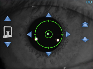 Microscope Spéculaire Corneal Entièrement Automatisé pour l'Évaluation Préopératoire et le Suivi Postopératoire du Corne - Product Image 5