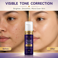 Sérum Correcteur Anti-Taches Brunes et Anti-Âge à Marque Blanche pour le Visage et le Corps – Éliminateur de Mélasma et d'Hyperpigmentation