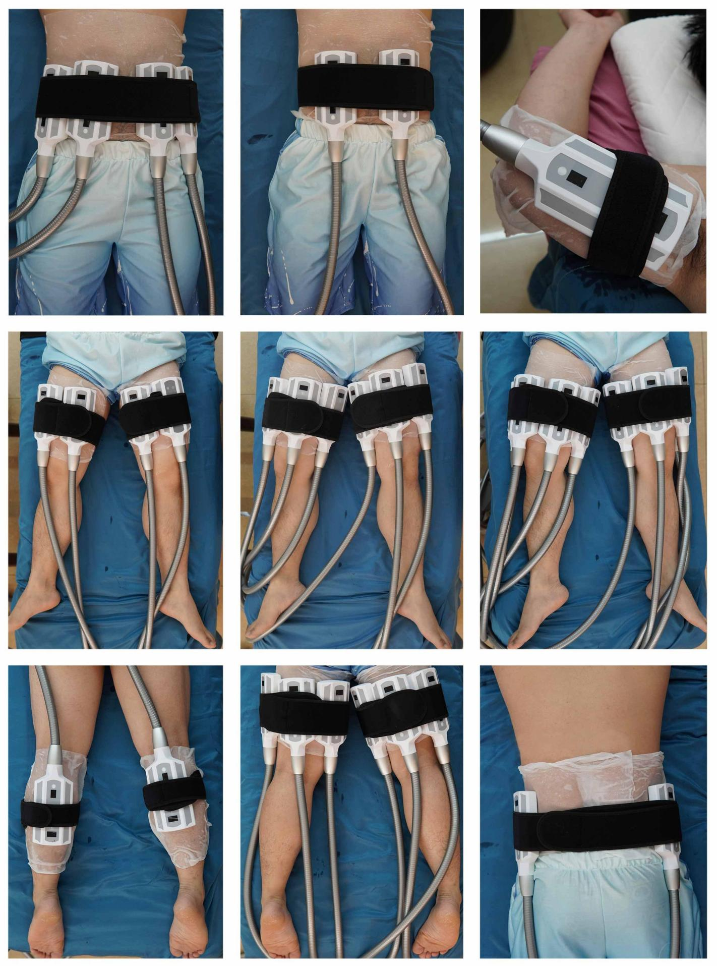 2022 Newest Technology! Portable Cool cryo plate machine /fat removal machine cryolipolysis slimming machine