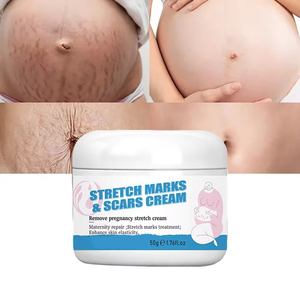 Crème <span class=keywords><strong>anti</strong></span>-vergetures naturelle organique Lotion hydratante raffermissante <span class=keywords><strong>anti</strong></span>-<span class=keywords><strong>cicatrice</strong></span> <span class=keywords><strong>efficace</strong></span> et rapide pour le corps - Product Image 1