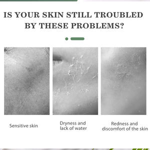 Essence de spray d'acide hypochloreux OEM pour la réparation de la barrière cutanée, cliniquement prouvée pour réduire les rougeurs, accélère la cicatrisation des plaies - Product Image 3