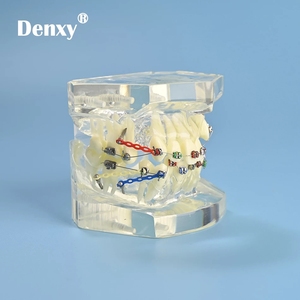 Denxy-modelo de ortodoncia para ortodoncia Dental, modelo principal transparente extraíble, soporte de Metal transparente, ligadura, atado de dientes - Product Image 5