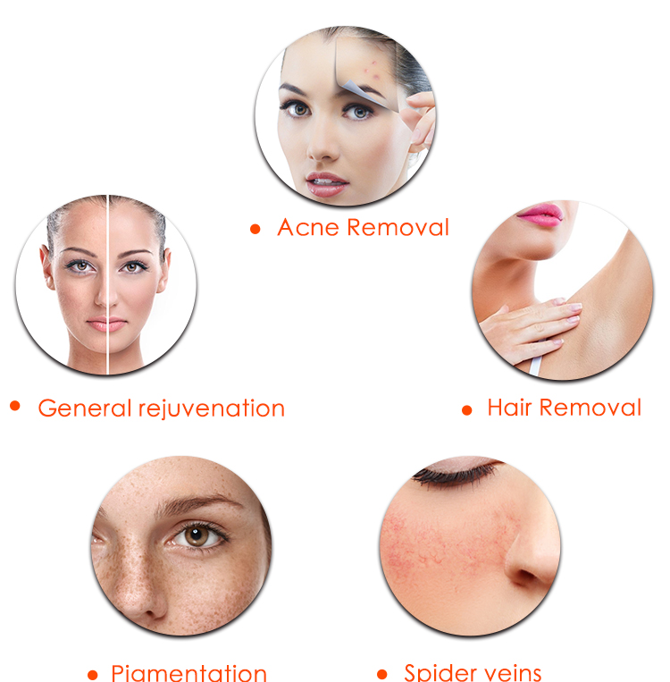 2 In 1 IPL Diode Laser Hair Removal Skin Rejuvenation Beauty Salon Equipment