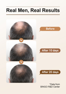 OEM ekstrak jahe profesional perawatan rambut Herbal Anti rontok merangsang Serum penumbuh rambut sampo Set Perawatan Rambut - Product Image 5