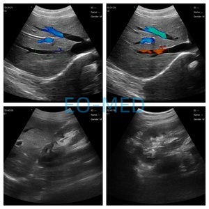 Sonde médicale sans fil à 192 éléments à matrice convexe pour échographie vétérinaire avec imagerie diagnostique de haute qualité CU11B - Product Image 6