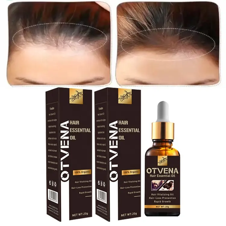 Aceite Vegano para el crecimiento del cabello, aceite aromático para la prevención de la caída del cabello, OEM/ODM
