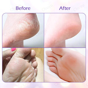 Kit de soins pour les pieds à l'<span class=keywords><strong>huile</strong></span> <span class=keywords><strong>essentielle</strong></span> de <span class=keywords><strong>lavande</strong></span>-Ensemble SPA en 5 étapes avec calmant, exfoliant et hydratant pour des pieds rafraîchis et soyeux - Product Image 3