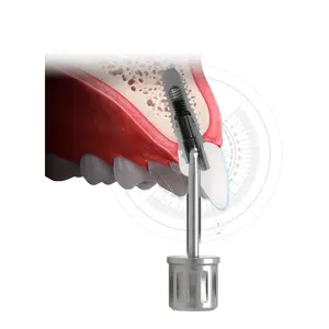 Hiossen 0ss 3i Dio pilier d'<span class=keywords><strong>implant</strong></span> dentaire Tournevis dynamométrique à angle de 1.2mm Source d'alimentation manuelle - Product Image 4