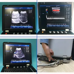 पेशेवर हृदय निदान cw 3 डी 4 डी इकोकार्डियोग्राफी रंग डॉपलर अल्ट्रासाउंड मशीन