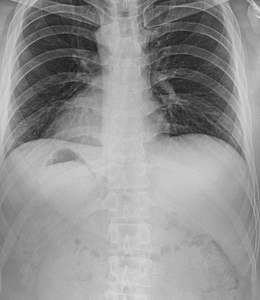 Detector de Panel Plano de Rayos X Digital Inalámbrico de Envío Rápido, Equipo de Radiografía para Hospitales y Clínicas, Careray 17x17 - Product Image 5