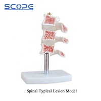 Instrumento de enseñanza de maniquí médico, simulador anatómico de esqueleto, modelo de osteoporosis humana de 3 vértebras, SC-A1022