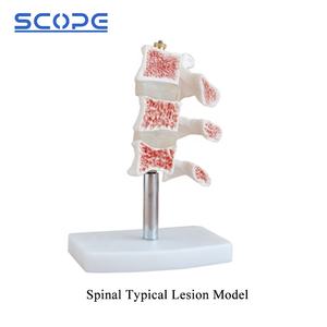 Instrumen pengajaran manekin medis, Simulator anatomi kerangka SC-A1022 3 vertebra Model Oba manusia - Product Image 3