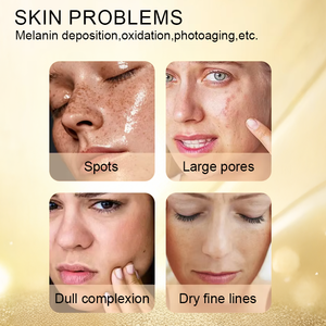 FASYDNI Serum perawatan kulit mewah, pemutih dan Anti Penuaan untuk menghilangkan bintik hitam - Product Image 3