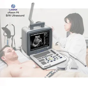 LANNX uRason P8畅销超声诊断系统便携式医用笔记本电脑黑白超声扫描仪