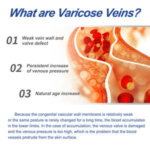 Vente en gros de crème pour les varices crème apaisante pour les jambes crème cicatrisante pour les varices à base de plantes pommade - Product Image 4