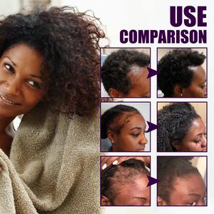 زيت باتانا الخام 100% غير مكرر من هندوراس بعلامة تجارية خاصة، زبدة زيت باتانا الطبيعية العضوية النقية لنمو الشعر من د. سيبر - Product Image 3