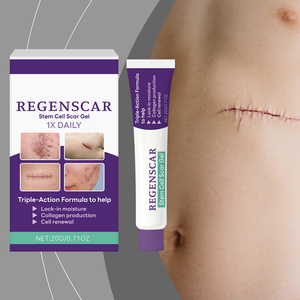 Crema para Eliminar Cicatrices, Hiperplasia, Quemaduras, Lesiones por Escaldaduras, Cicatrices Quirúrgicas, Estrías, Eliminador de Cicatrices y Marcas - Product Image 6