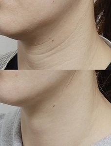 Crema de Suero para el Cuello con Colágeno KXY Smooth Lines, Hidrata, Reafirma y Tensa el Cuello - Product Image 5