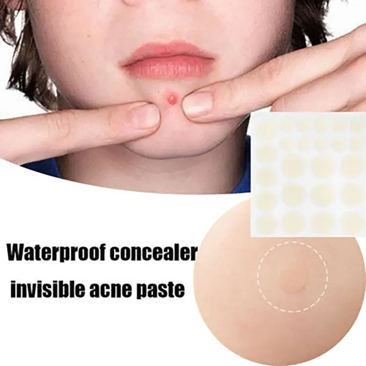 ピンプルパッチ顔と肌のためのジットと傷のスポットステッカーをカバーするためのハイドロコロイドアクネピンプルパッチ