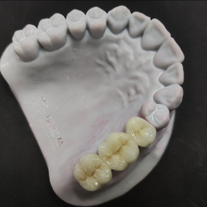 ฟันปลอม3D ไฟฟ้าสำหรับฟันเซรามิกรูปมงกุฎและพอร์ซเลนเซอร์โคเนียสำหรับฟันเทียม - Product Image 1