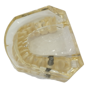 علوم طبية دراسة طبيب الأسنان موارد تعليمية إلكترونية محاكاة عالية الجودة راتنج زرع الأسنان الفك السفلي - Product Image 2