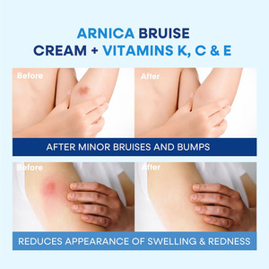 Private Label Natural Arnica <strong>Bruise</strong> <strong>Cream</strong> <strong>for</strong> Thin Skin - Moisturizing, Vitamin K C and E, Skin Renewal - Product Image 6