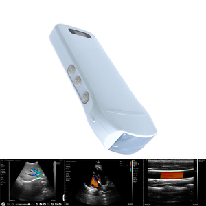 Konted MDR 3 in 1 senza fili convesso/lineare/cardioecografia a colori Doppler Wireless sonda ecografica kontted - Product Image 2