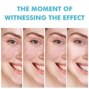 Gel Asam Salisilat Kelas Klinis untuk Perbaikan Cepat, Penghalus Pori Mendalam, Penghilang Bekas Jerawat, dan Perawatan Penghalus Kulit - Product Image 6