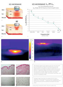 2026 2.45GHz Slimming Freezewave 80% Eliminación de Grasa Coolwave Contorno Corporal 500W para Modelado de Grasa - Product Image 3