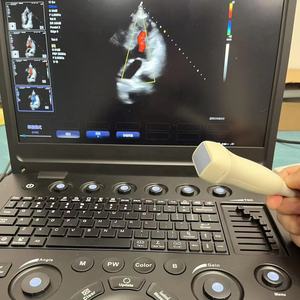Meilleur prix pour un appareil d'échographie portable pour clinique et hôpital, avec option <span class=keywords><strong>3D</strong></span> - Product Image 3