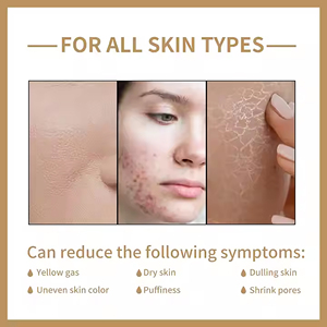 Eau d'essence radiante bio-polysaccharide OEM/ODM: liquide filtrant fermenté, <span class=keywords><strong>acide</strong></span> <span class=keywords><strong>hyaluronique</strong></span>, pour une peau éclatante - Product Image 4