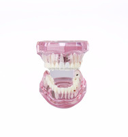 Modelo Dental de Puente de Restauración Dental con Dientes Removibles Estándar, Modelo de Resina para Implantes, Modelo de Tipodonto para Enfermedades Dentales, para Estudio de Ciencias Médicas y Odontología