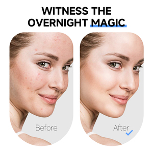 Cerotti Idrocolloidali per Brufoli e Imperfezioni da 36 Pezzi, Idratanti e Antirughe, Prodotti di Bellezza per la Cura della <span class=keywords><strong>Pelle</strong></span> per Tutti i Tipi di <span class=keywords><strong>Pelle</strong></span> - Product Image 3