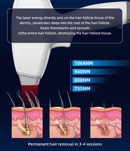 Épilateur <span class=keywords><strong>laser</strong></span> diode 808 nm efficace 1000W 1200W avec pièces détachées gratuites – Appareil professionnel pour salon de beauté et clinique - Product Image 5