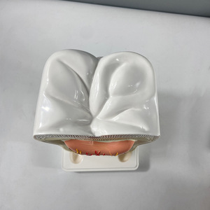 Modelo de Anatomía Humana Ampliado para Enseñanza de Biología y Ciencias Médicas, Modelo de Dientes Molares de 2 Partes con Decadencia Dental - Product Image 3