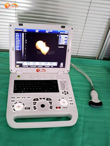 फैक्टरी मूल्य 3डी अल्ट्रासाउंड पोर्टेबल कलर अल्ट्रासाउंड मशीन SUN-800D - Product Image 2